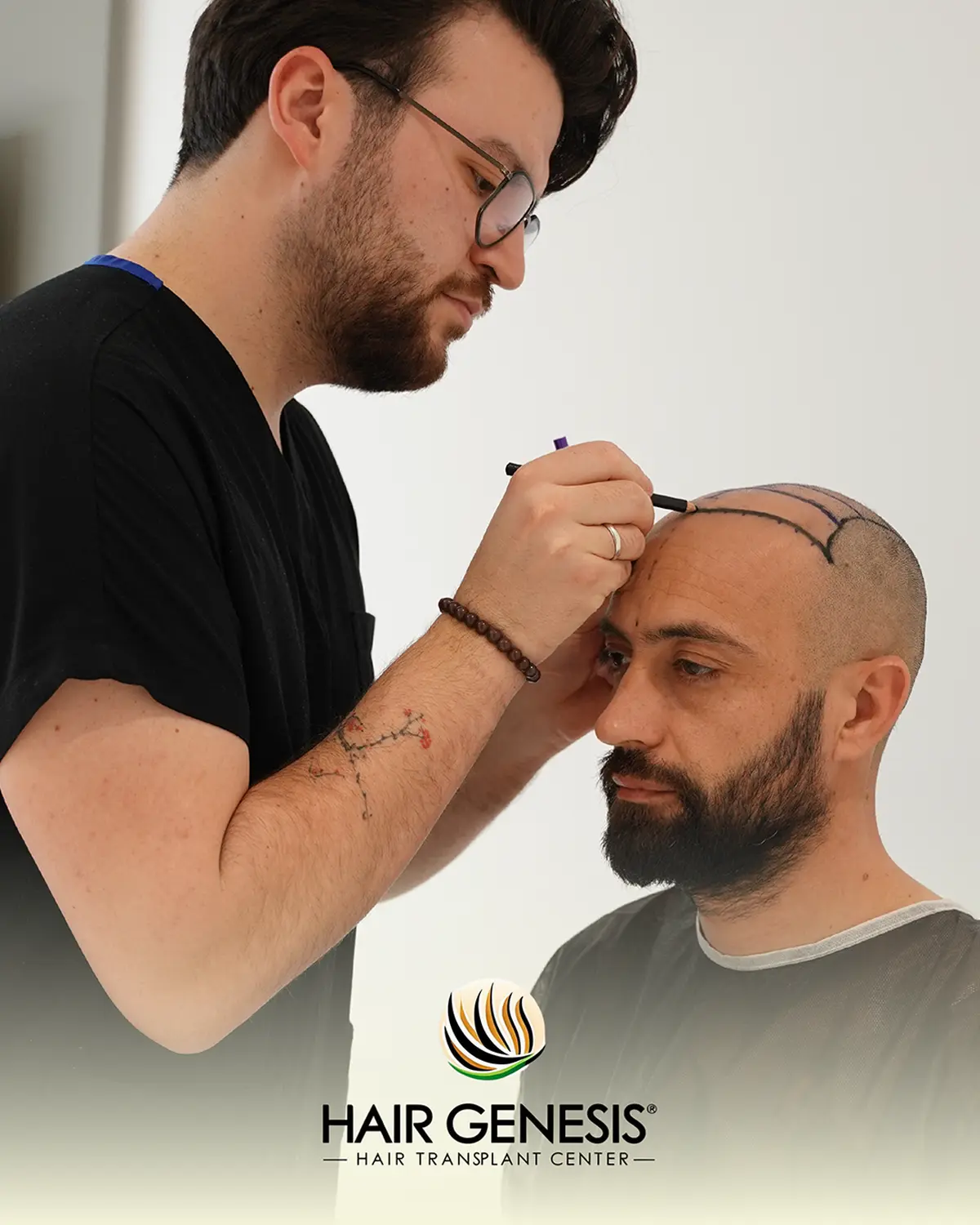 Hair Genesis - Haartransplantation